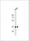Deoxyguanosine Kinase (DGUOK) Antibody (C-term)